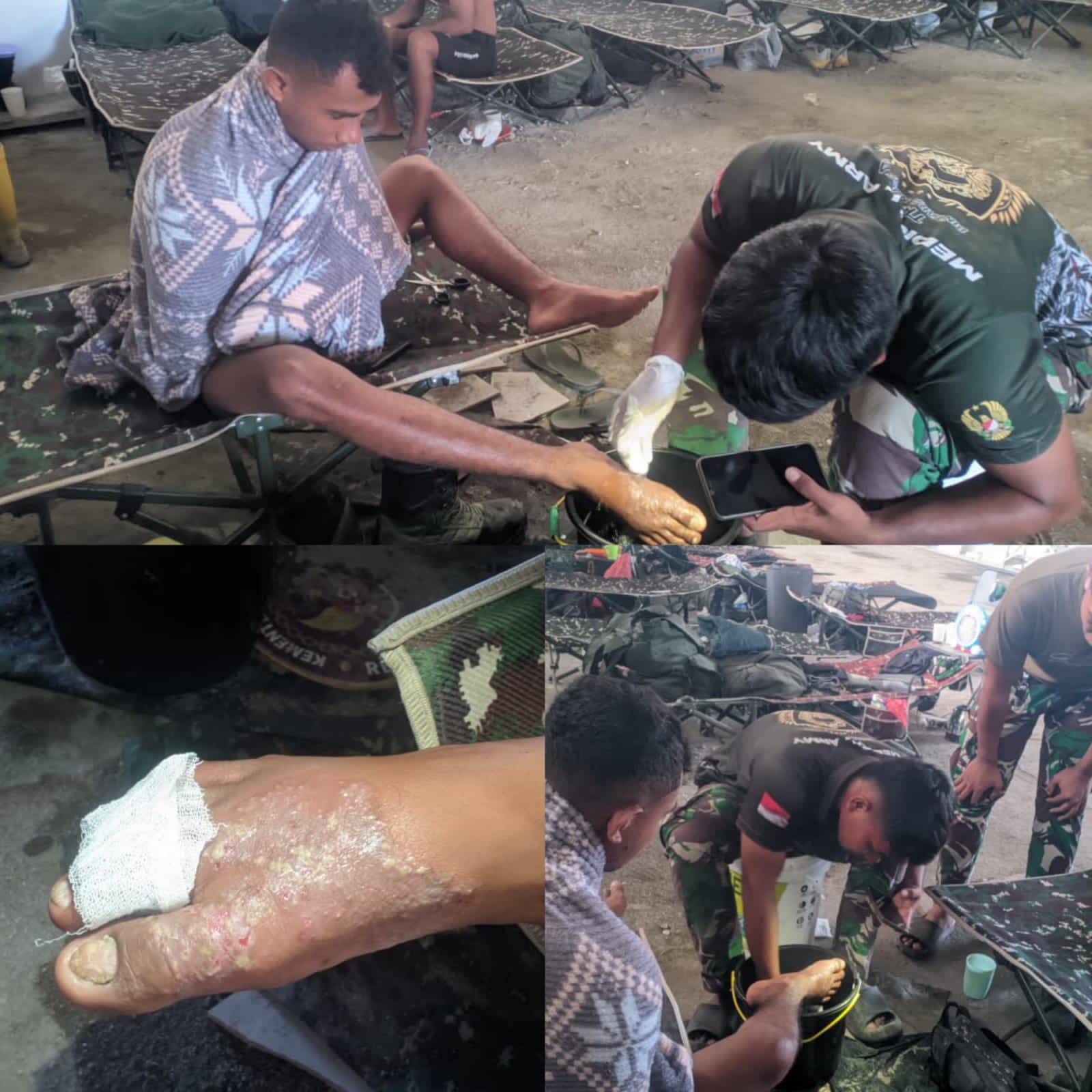 IMG-20260520-WA0077 Tenaga Kesehatan TMMD Tangani Personel yang Mengalami Iritasi Semen