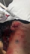 IMG_20260611_171702 Labuan Bajo Geger, Empat Brimob Terluka dalam Insiden Penikaman yang Diduga Libatkan Oknum TNI