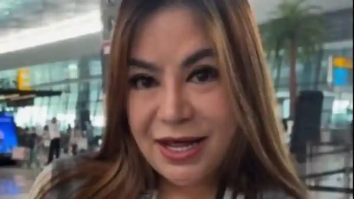 Lima Kali Operasi Hidung, Anisa Bahar Ceritakan Biaya dan Alasan Revisi